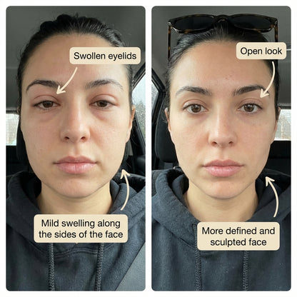 Lymphatic Drainage Drops (Special Offer)